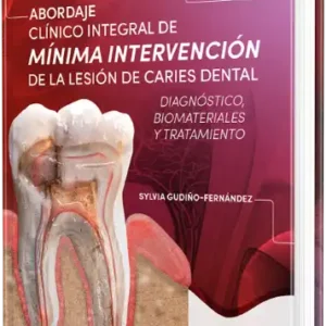 Abordaje Clínico Integral de Mínima Intervención de la Lesión de Caries Dental