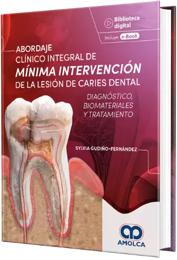 Abordaje Clínico Integral de Mínima Intervención de la Lesión de Caries Dental