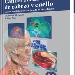 Cáncer Recurrente de Cabeza y Cuello