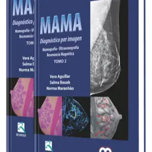 Mama. Diagnóstico por Imagen