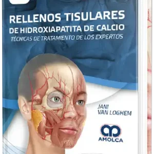 Rellenos Tisulares de Hidroxiapatita de Calcio. Técnicas de tratamiento de los expertos