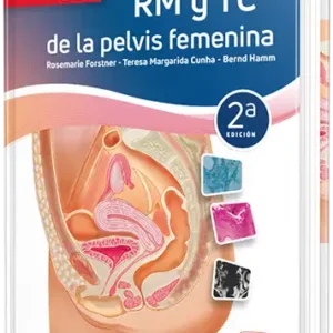 RM y TC de la pelvis femenina