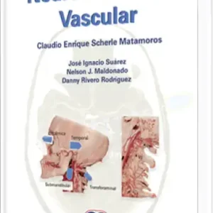 Neurosonología Vascular