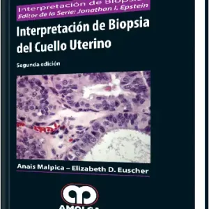 Interpretación de Biopsia del Cuello Uterino 2 Edición