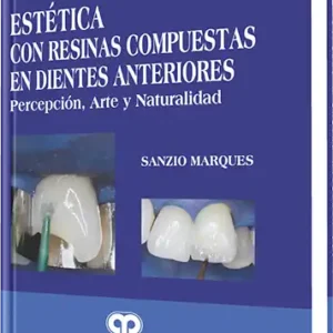 Estética con Resinas Compuestas en Dientes Anteriores