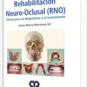 Rehabilitación Neuro-Oclusal (RNO)