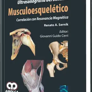 Ultrasonografía del Sistema Musculoesquelético