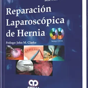 Reparación Laparoscópica de Hernia