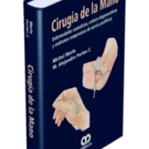 Cirugía de la Mano