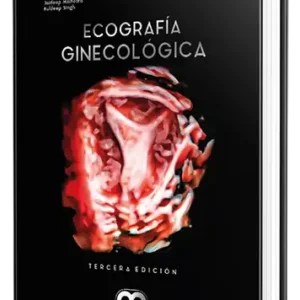 Ecografía ginecológica