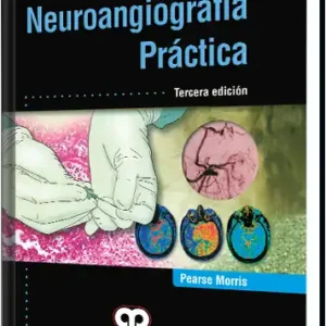 Neuroangiografía Práctica. 3 Edición