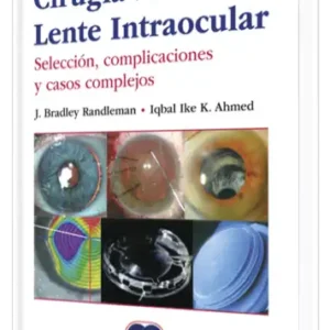 Cirugía de Lente Intraocular