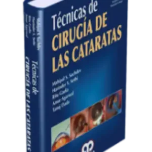 Técnicas de Cirugía de las Cataratas