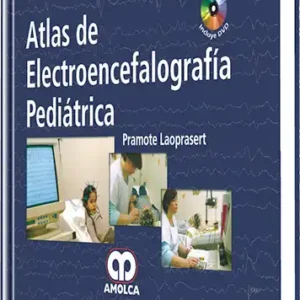 Atlas de Electroencefalografía Pediátrica