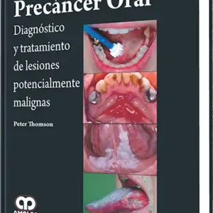 Precáncer Oral.  Diagnóstico y Tratamiento de Lesiones Potencialmente Malignas