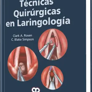 Técnicas Quirúrgicas en Laringología
