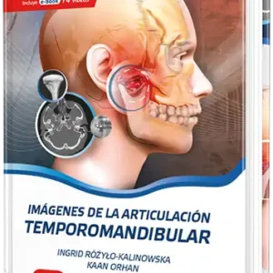 Imágenes de la Articulación Temporomandibular