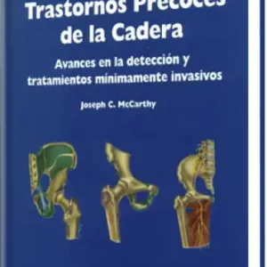 Trastornos Precoces de la Cadera