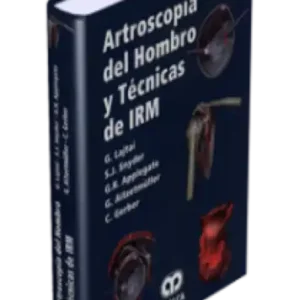 Artroscopia del Hombro y Técnicas de IRM