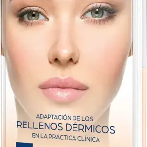Adaptación de los rellenos dérmicos en la práctica clínica
