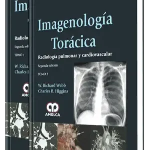 Imagenología Torácica.  Radiología Pulmonar y Cardiovascular 2 Edición