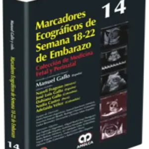 Marcadores Ecográficos de Semana 18-22 de Embarazo. Volumen 14