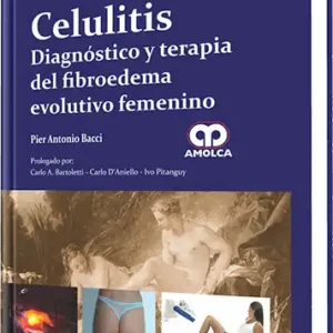 Celulitis. Diagnóstico y Terapia del Fibroedema Evolutivo Femenino