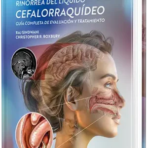 Rinorrea del líquido cefalorraquídeo. Guía completa de evaluación y tratamiento