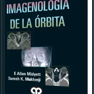 Imagenología de la Órbita