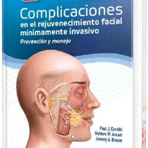 Complicaciones en el rejuvenecimiento facial mínimamente invasivo  - Prevención y manejo