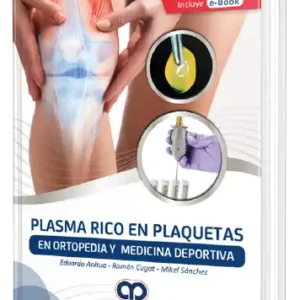 Plasma Rico en Plaquetas en Ortopedia y Medicina Deportiva