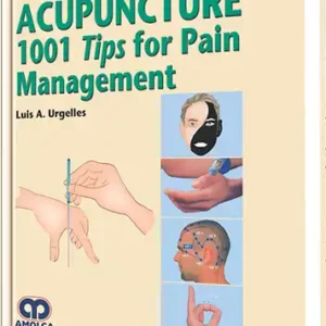 Acupuncture 1001 Tips For Pain Management