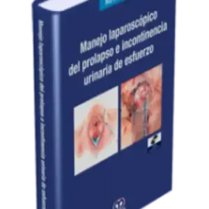 Manejo Laparoscópico del Prolapso e Incontinencia Urinaria de Esfuerzo