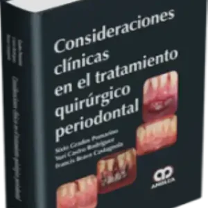 Consideraciones Clínicas en el Tratamiento Quirúrgico Periodontal