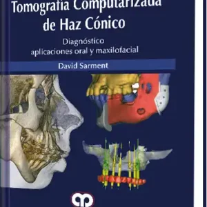 Tomografía Computarizada de Haz Cónico