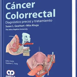 Cáncer Colorrectal