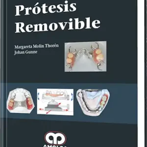 Prótesis Removible