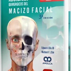 Abordajes Quirúrgicos del Macizo Facial. 3a Edición