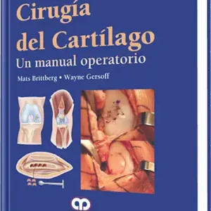 Cirugía del Cartílago. Un Manual Operatorio