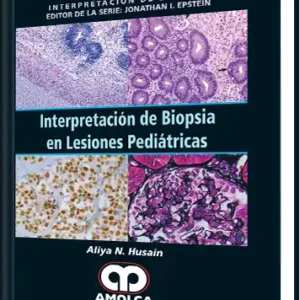 Interpretación de Biopsia en Lesiones Pediátricas