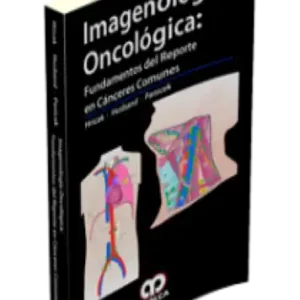 Imagenología Oncológica: Fundamentos del Reporte en Cánceres Comunes