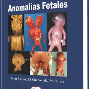 Escuela Donald Atlas de Anomalías Fetales