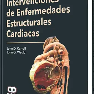 Intervenciones de Enfermedades Estructurales Cardiacas