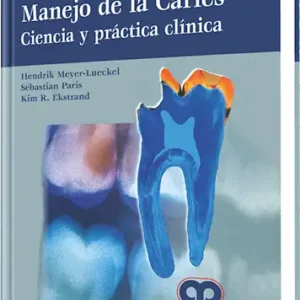 Manejo de la Caries Ciencia y práctica clínica