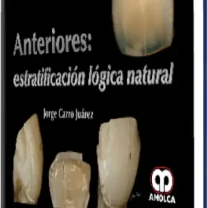 Anteriores: Estratificación Lógica Natural