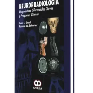 Neurorradiología