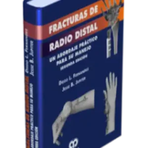 Fracturas de Radio Distal. 2 Edición
