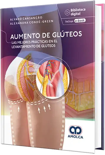 Aumento de glúteos. Las mejores prácticas en el levantamiento de glúteos