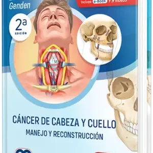Cáncer de Cabeza y Cuello - Manejo y Reconstrucción