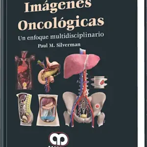 Imágenes Oncológicas